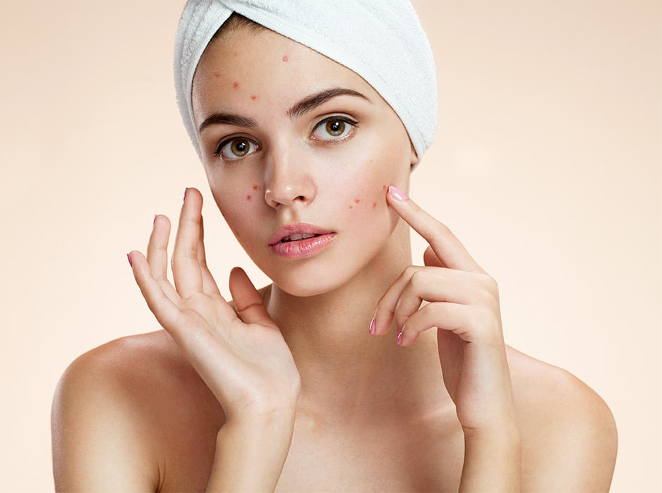 Dermaceutic | Tratamiento del Acné