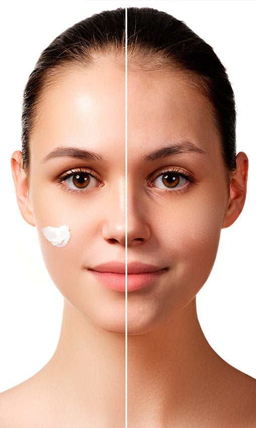 Dermaceutic | Cuidado de la piel - Pigmentación